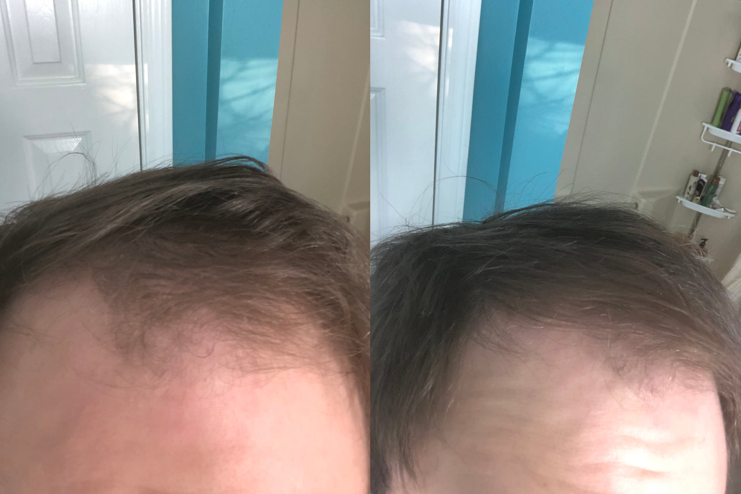 How Simfort Gave Me The Thicker Hair I’ve Been Longing For