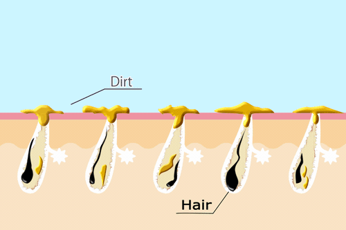solve Hair Loss